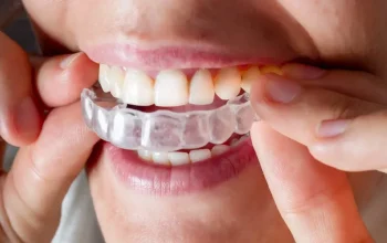 Navigating the Journey to Better Oral Health with Invisalign