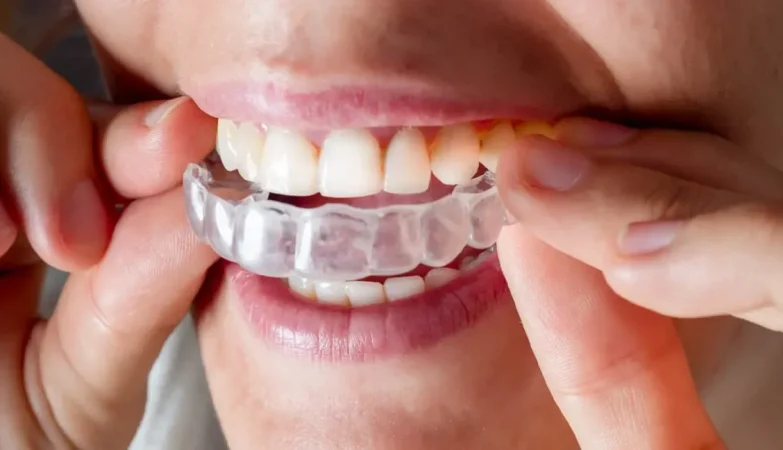 Navigating the Journey to Better Oral Health with Invisalign