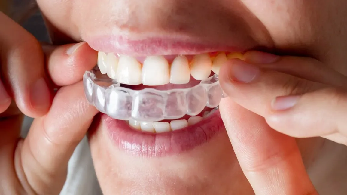 Navigating the Journey to Better Oral Health with Invisalign